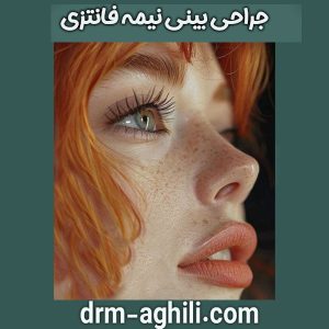 جراحی بینی نیمه فانتزی