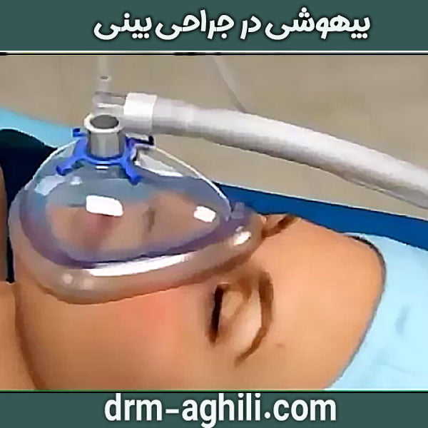 بیهوشی در جراحی بینی دکتر عقیلی در گرگان