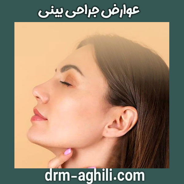 rhinoplasty complications