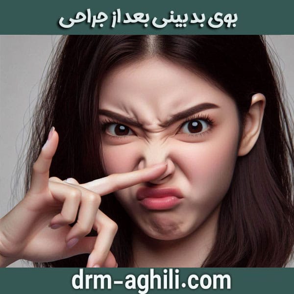بوی بد بینی بعد از جراحی دکتر محمدرضا عقیلی بهترین جراح بینی در گرگان