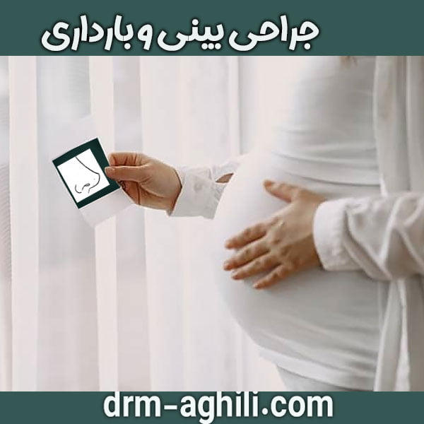 جراحی بینی و بارداری دکتر عقیلی در گرگان