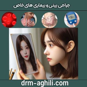 جراحی بینی و بیماری های خاص دکتر محمدرضا عقیلی در گرگان