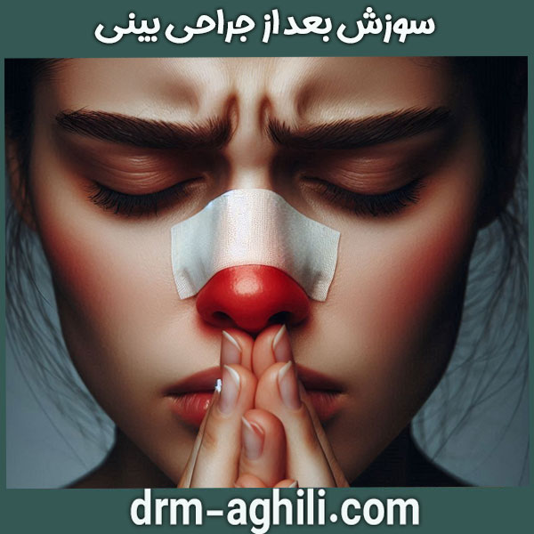 سوش بینی بعد از جراحی از دکتر محمدرضا عقیلی در گرگان