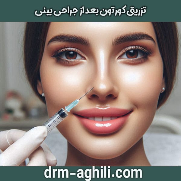 تزریق کورتون بعد از جراحی بینی دکتر عقیلی بهترین جراح بینی گرگان