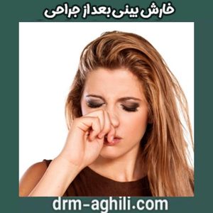 خارش بینی بعد از جراحی