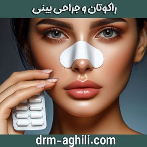 راکوتان و جراحی بینی از دکتر محمدرضا عقیلی بهترین جراح بینی در گرگان
