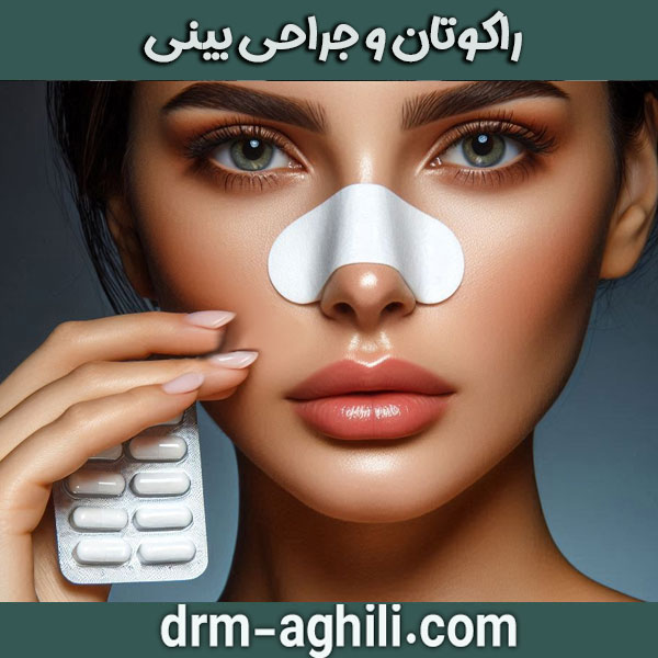 راکوتان و جراحی بینی از دکتر محمدرضا عقیلی بهترین جراح بینی در گرگان
